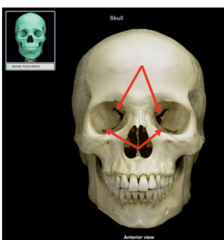 <p>What major opening is the top arrow pointing to? (ANTERIOR VIEW)</p>