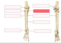 <p>What should go in the highlighted red blank?</p>