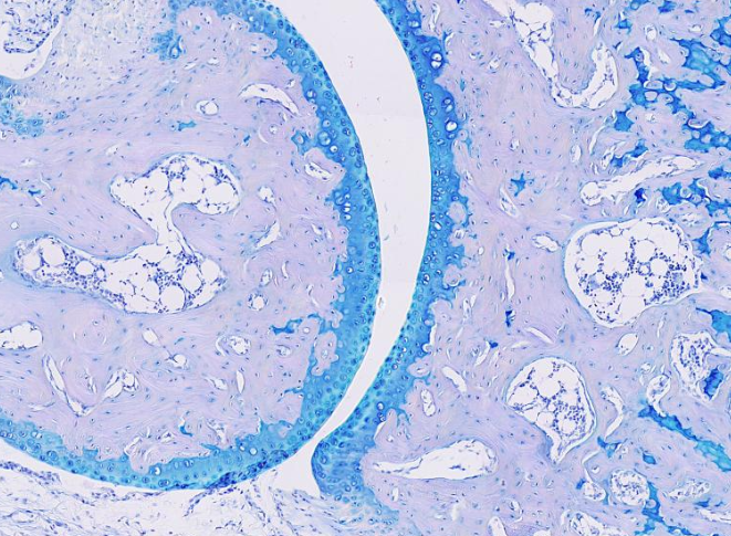 <p>Este tejido es rico en <strong>glucosaminoglicanos y proteoglucanos</strong>, además de contener colágeno y otras fibras. Selecciona el sitio anatómico donde se puede encontrar el tejido:</p>
