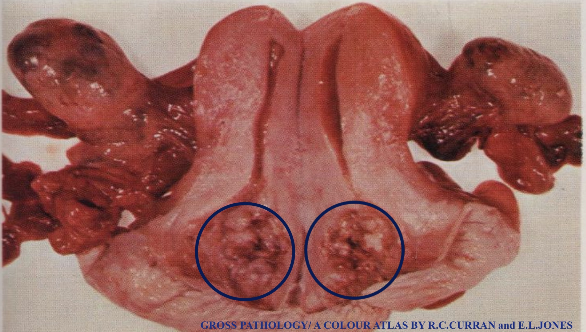 term image