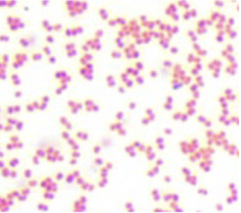 <p>Gram and morphology of this bacteria: pink to red stained bacteria with a spherical to bean shaped morphology</p>