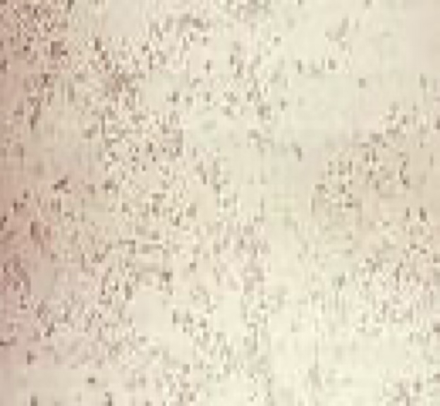 <ul><li><p>Seen in alkaline urine.</p></li><li><p>Appear as granular precipitate.</p></li></ul><p></p>