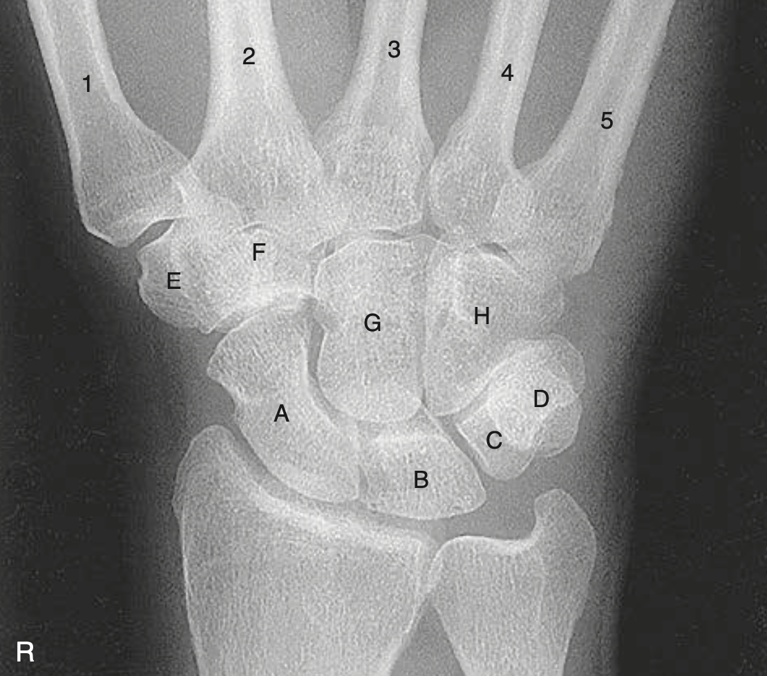 <p>E</p>