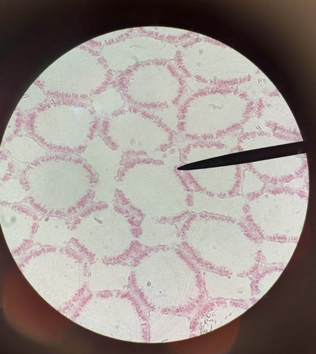 <p>subkingdom parazoa</p><p>phylum porifera</p><p>spongocoel and choanocytes</p>
