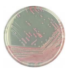 <p>What is Chromagar MRSA II selective for?</p>