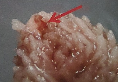 <p>what is this on the sea star</p>