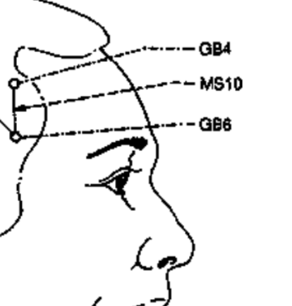 <p>On the anterior-temporal line from GB 4 to GB 6 (straight line down)</p><p>-disorders of head, face and neck</p>