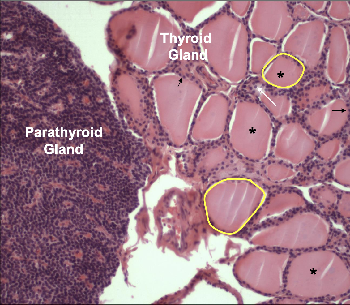 <p>What is circled in yellow </p>