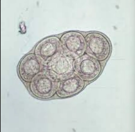 <p>what is it (Tapeworms/Cestodes)</p>