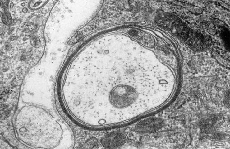 <p>What is this fiber covered by?</p>