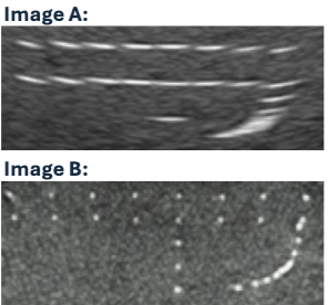 <p>Which image demonstrates BETTER lateral resolution and</p><p>WHY?</p>