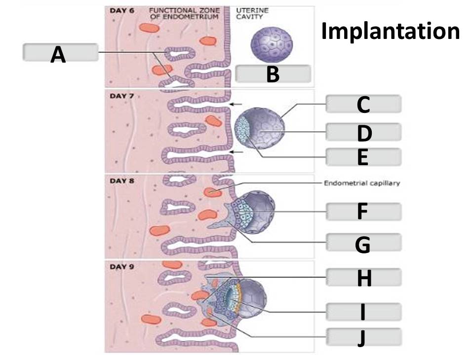 <p>Identify the implantation structure labeled "I".</p><p> </p><p>amniotic cavity</p><p> </p><p>cytotrophoblast</p><p> </p><p>lacuna</p><p> </p><p>trophoblast</p>