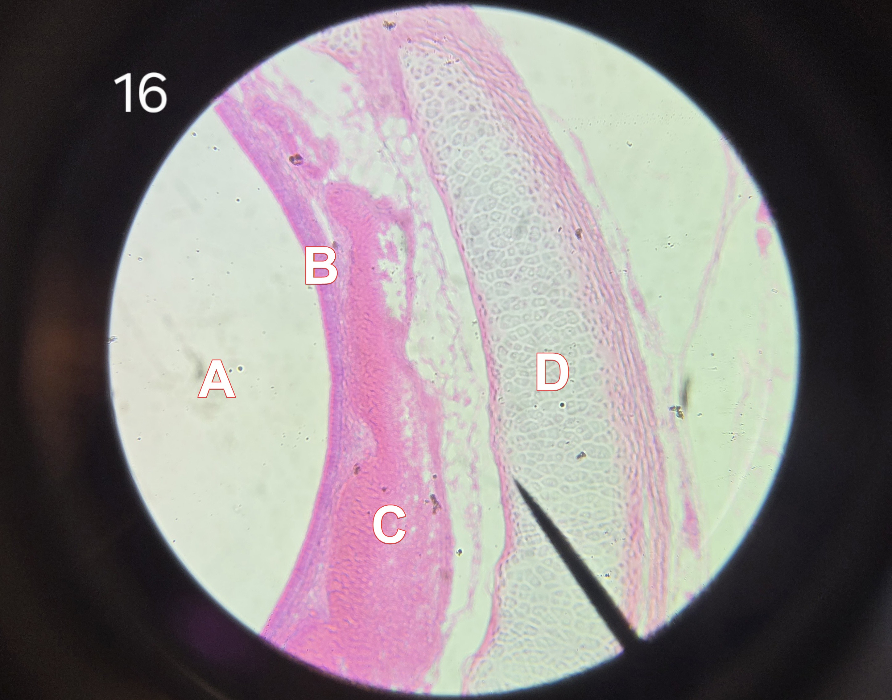 <p>What is <strong>Label 16</strong> the histology slide of?</p>