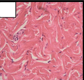 <p>Collagen</p><p>Swirly (random directions) and deep pink </p>