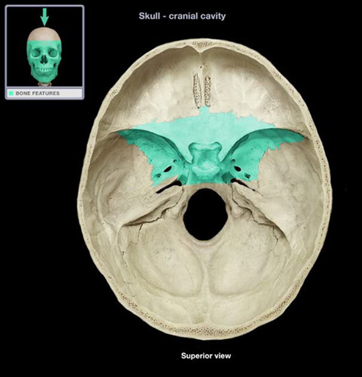 <p>ID highlighted bone</p>