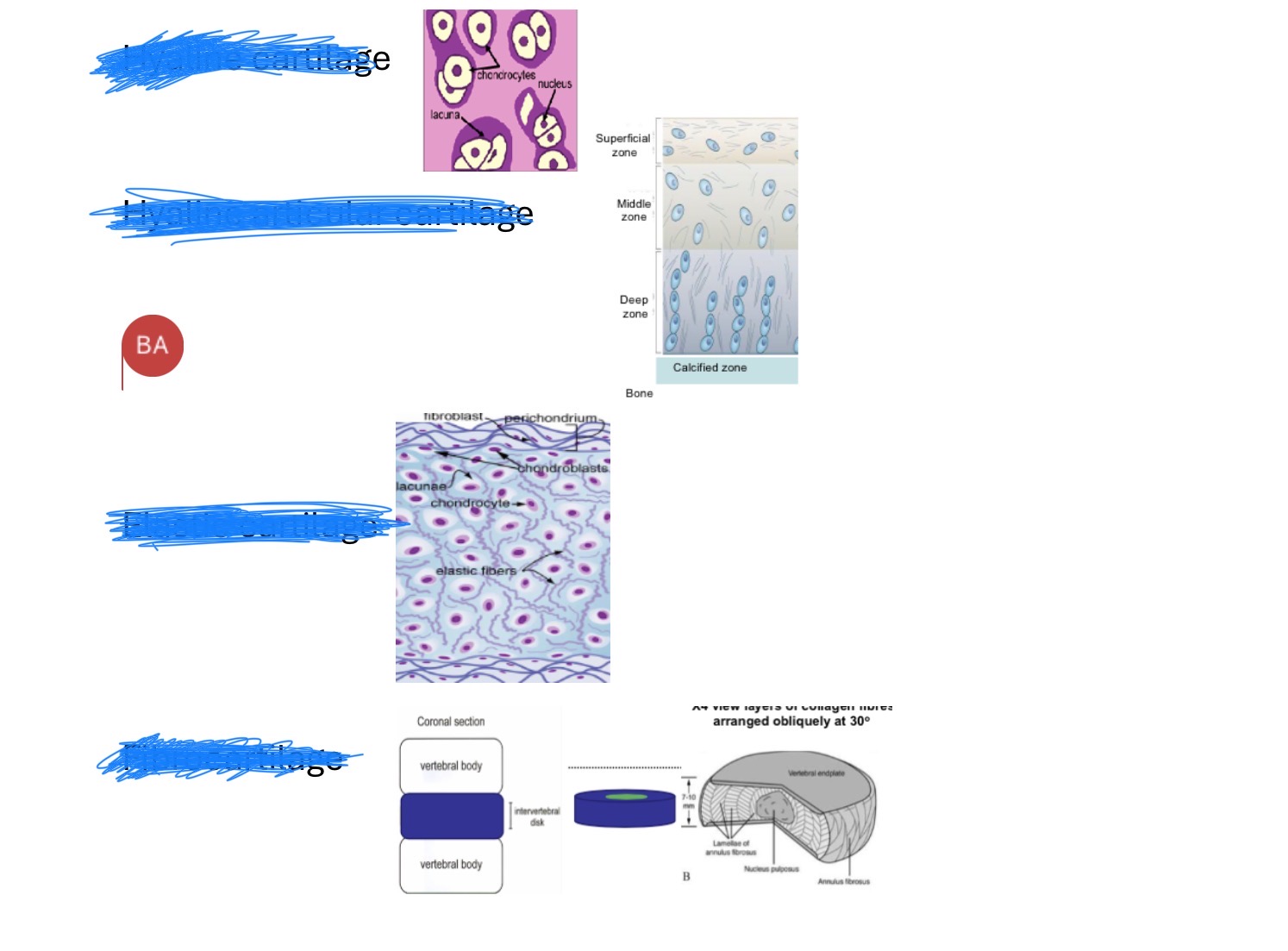 <p>label:</p><ul><li><p>fibrocartilage </p></li><li><p>hyaline articular cartilage </p></li><li><p>elastic cartilage </p></li><li><p>hyaline cartilage </p></li></ul><p></p>