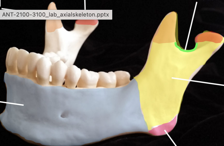 <p>What is the red highlighted bone?</p>
