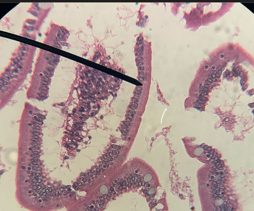 <p>ID tissue</p>