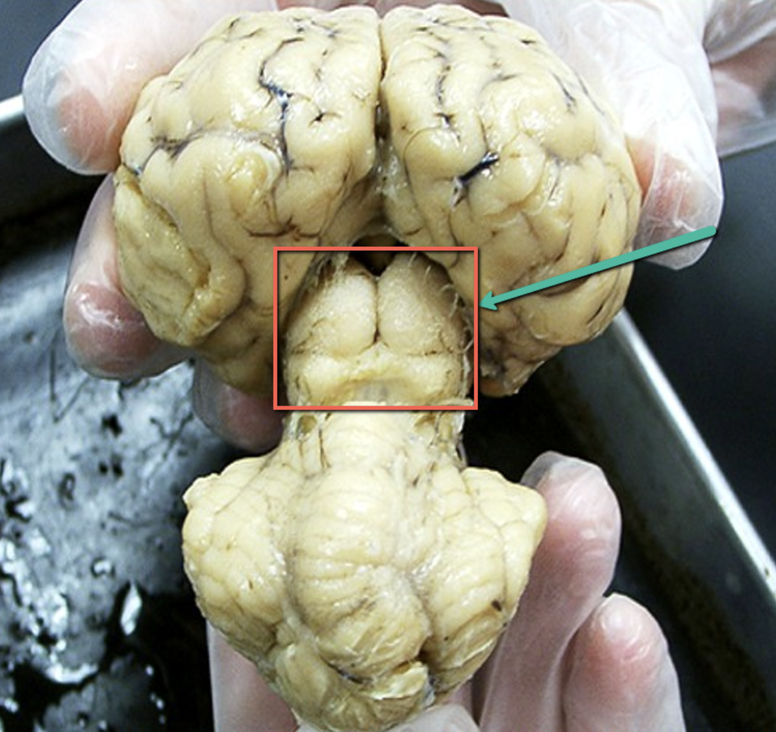 <p>Identify the structure indicated by the pointer.</p>