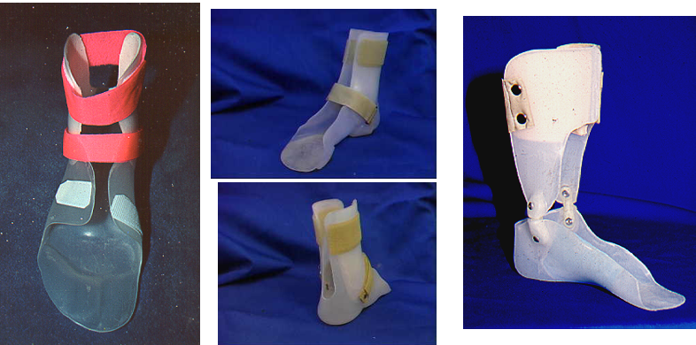 <ul><li><p>variety of different AFOs that have a reduced height calf section</p></li><li><p>may or may not have ankle joints, and can be fabricated for various levels of rigidity</p></li><li><p>often indicated for patients with pes planusI</p><ul><li><p>children - often due to neuromuscular disorders </p></li><li><p>adults - often a result of posterior tibial dysfunction or rupture</p></li></ul></li><li><p>They are best at controlling coronal motion and are not an effective lever arm for sagittal control of the ankle</p><ul><li><p> For medial lateral not sagittal plane</p><p></p></li></ul></li></ul><p></p>