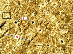 <p>What component of compact bone is labeled 1?</p>