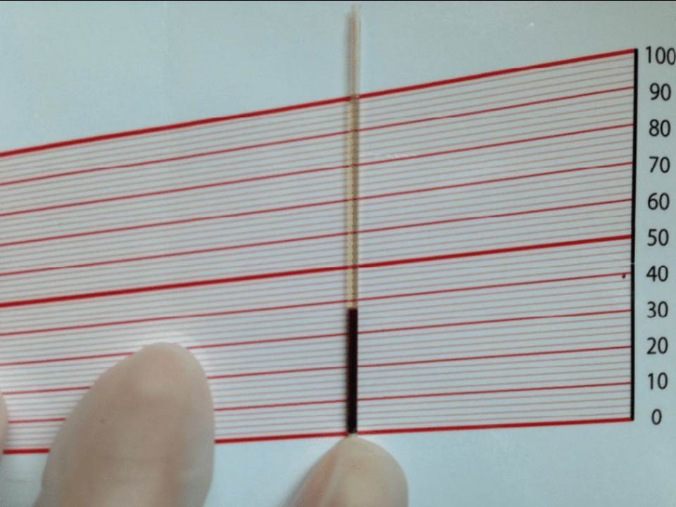 <p><span>The number you will report on the medical record based on the image below is</span></p>