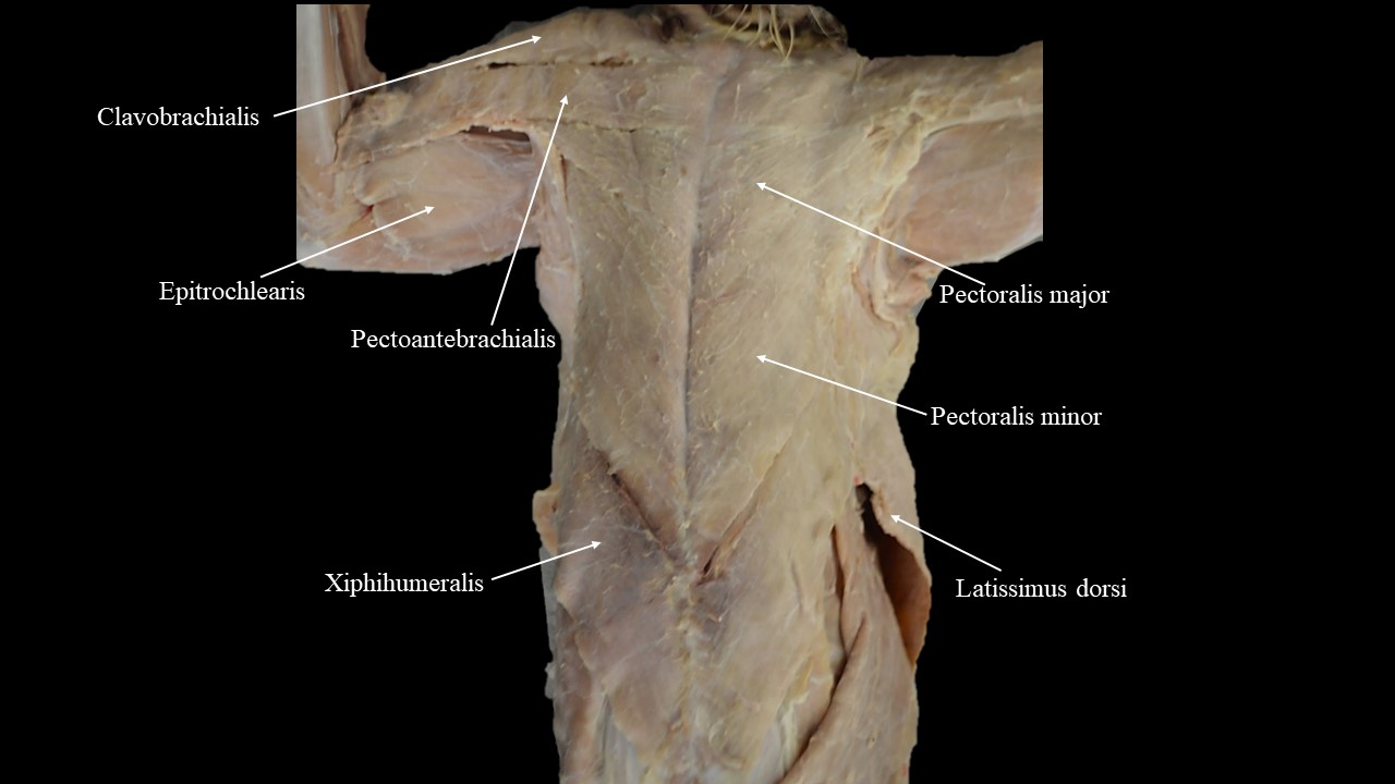<p>Ventral-cranial muscle group</p>
