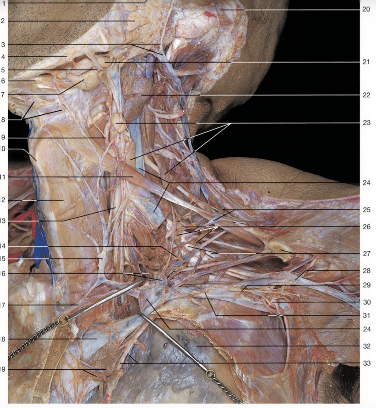 <p>Pinche 31</p>