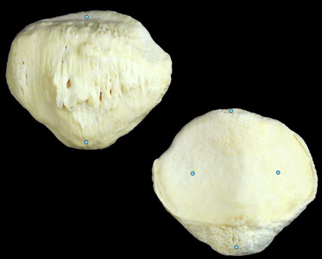 <p>what bone is this?</p>