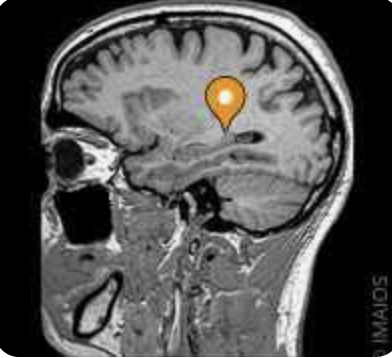 <p>Name the part of the brain, modality, and plane</p>