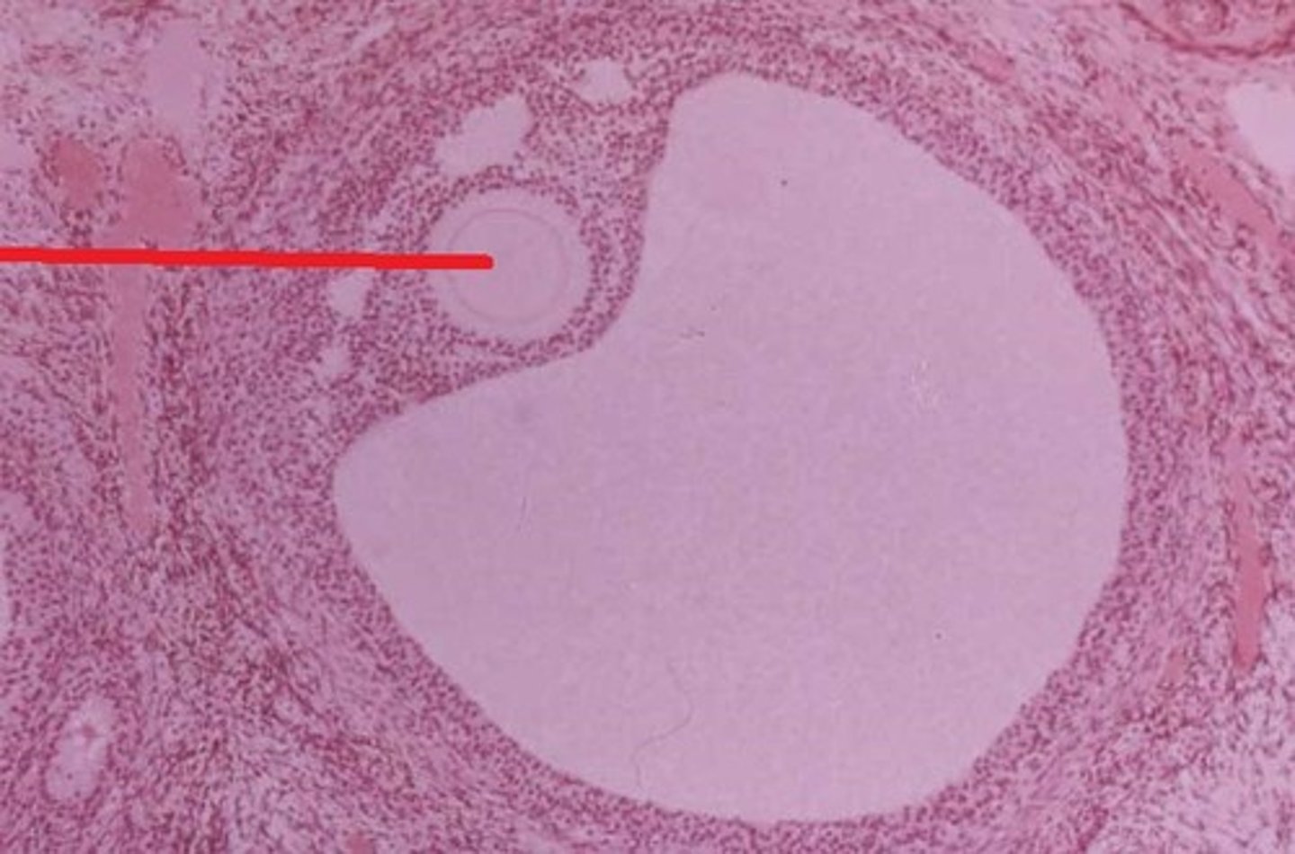 <p>Female gamete (egg cell) that becomes fertilized by sperm to begin development.</p>