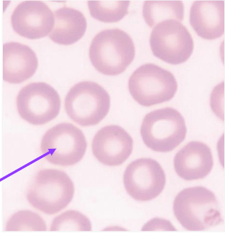 <p>Biconcave shape which creates a central pallor and high surface:volume ratio</p>