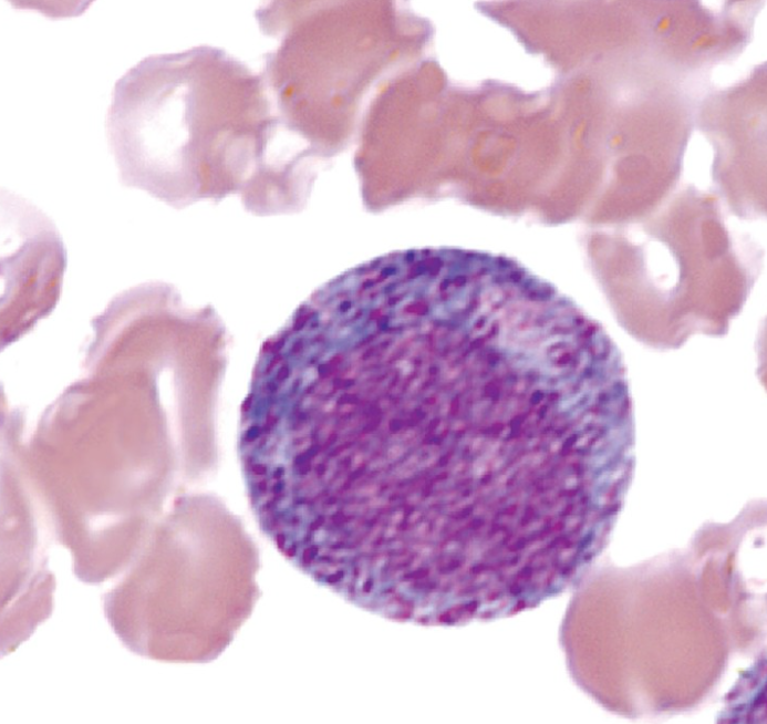 <p>What WBC precursor is this?</p>