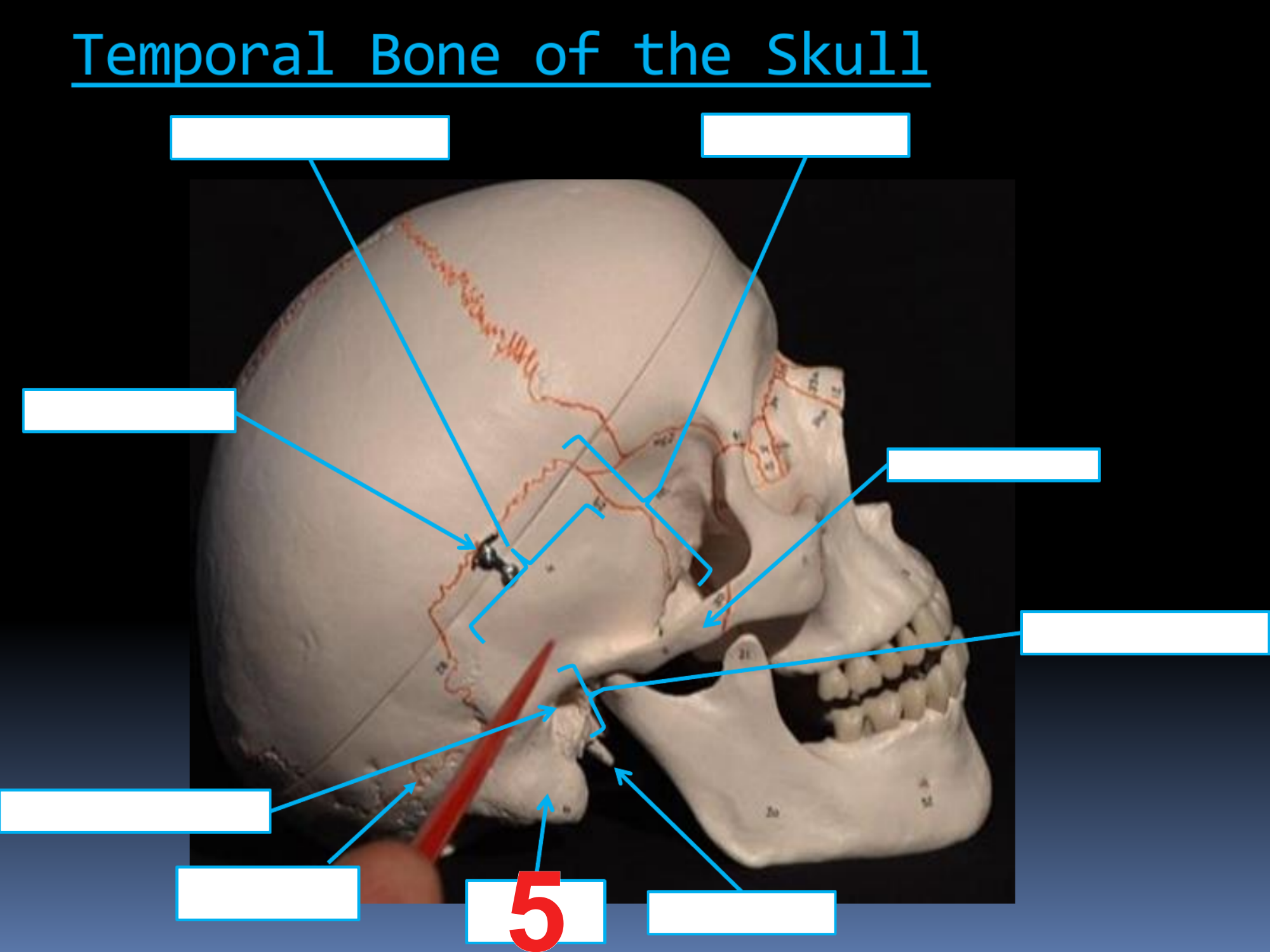 <p>#5</p>