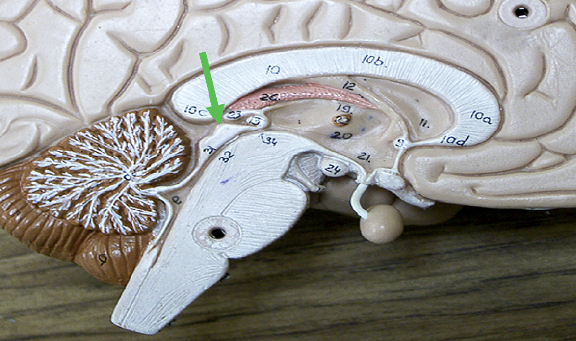 <p>Identify the area of the brain indicated by the pointer.</p>