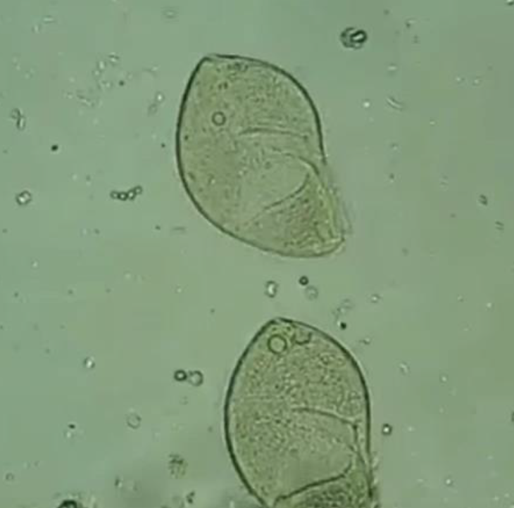 <p><em>Neobalantidium coli</em>: Disease</p>