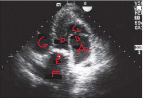 <p>What is at D? </p>