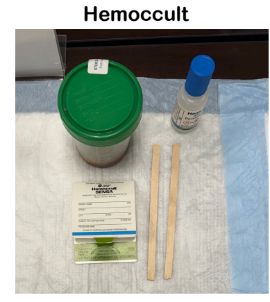 <ul><li><p><strong>Sample Collection</strong>: The patient provides a stool sample.</p><p></p></li><li><p></p><p><strong>Initial Step</strong>: Apply the sample to windows A and B, close the card, and wait 3–5 minutes.</p><p></p></li><li><p><strong>Development</strong>:</p><ul><li><p>Flip the card to the back side.</p><p></p></li><li><p>Apply two drops of developer over the stool smear.</p><p></p></li><li><p>Read results within 60 seconds; any trace of blue is a positive result.</p><p></p></li></ul></li><li><p><strong>Control Test</strong>:</p><ul><li><p>Apply one drop of developer between the positive (+) and negative (-) areas.</p><p></p></li><li><p>Read within 10 seconds.</p><p></p></li><li><p>A blue color must show in the positive area and no blue in the negative area</p></li></ul></li></ul><p></p>