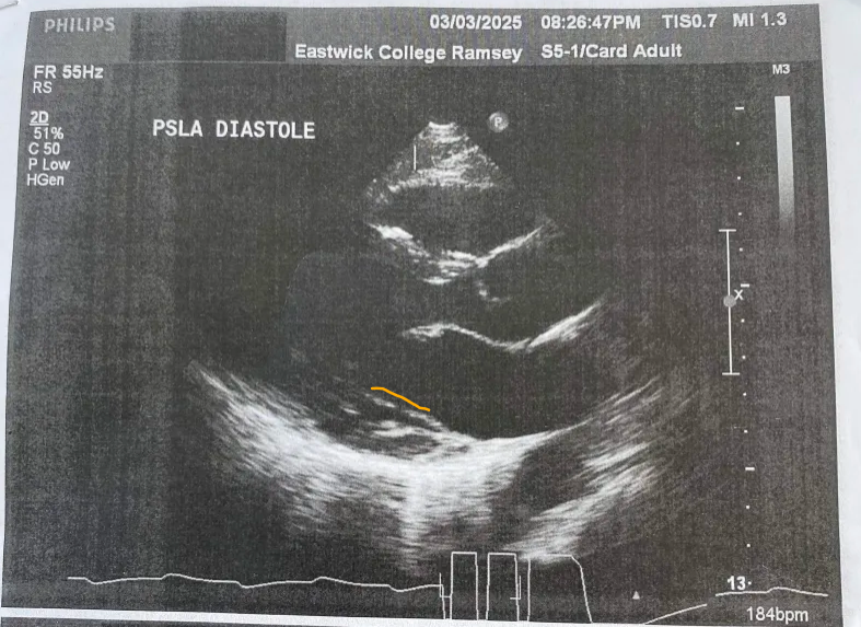 <p>What goes here?</p>