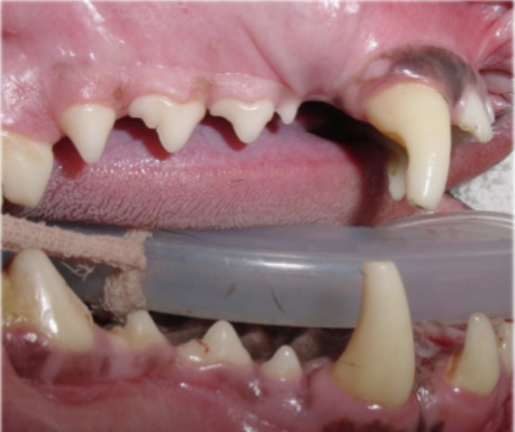 <p>What is the stage of periodontal disease shown in this image?</p>