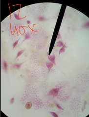 <p>• cells wit cellulose and TWO FLAGELLA in grooves</p><p>• marine and freswater</p><p>• CHLOROPHYLL A AND C</p><p>• causes red tides from red cartenoids</p><p>• symbiotic relationships with coral</p><p>• photoautotrophic, heterotrophic, or mixotrophic</p><p>• threadlike filaments</p>