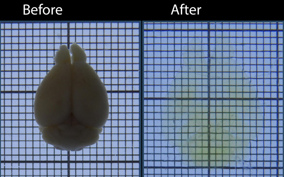 <p>fixes tissue to preserve the physical structures of proteins and nucleic acid by allowing light-scattering lipids to be removed. once the tissue is transparent it allows in-tact structures to be visualized (two photon microscope)</p>
