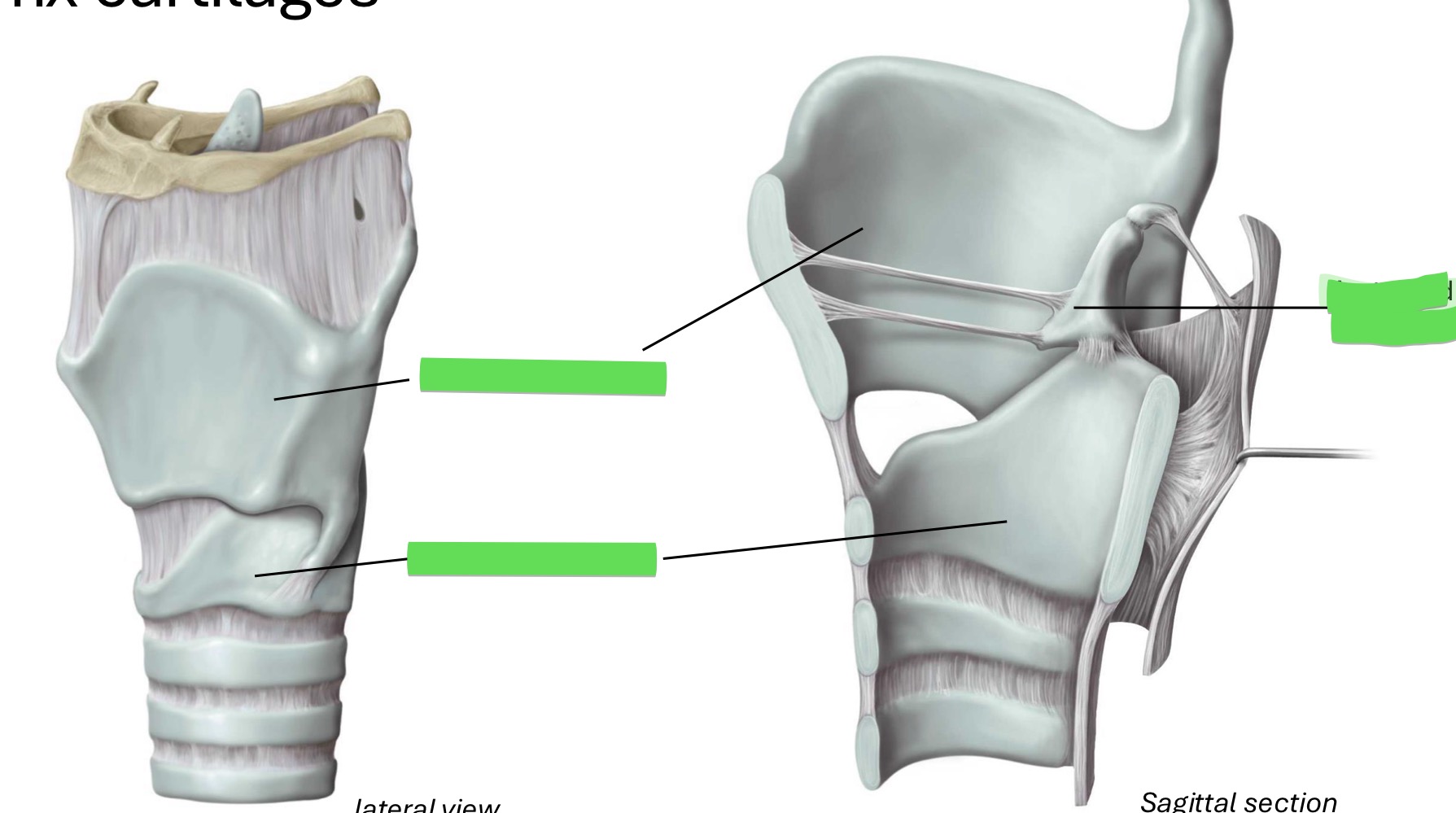 <p>Fill in the blank</p>