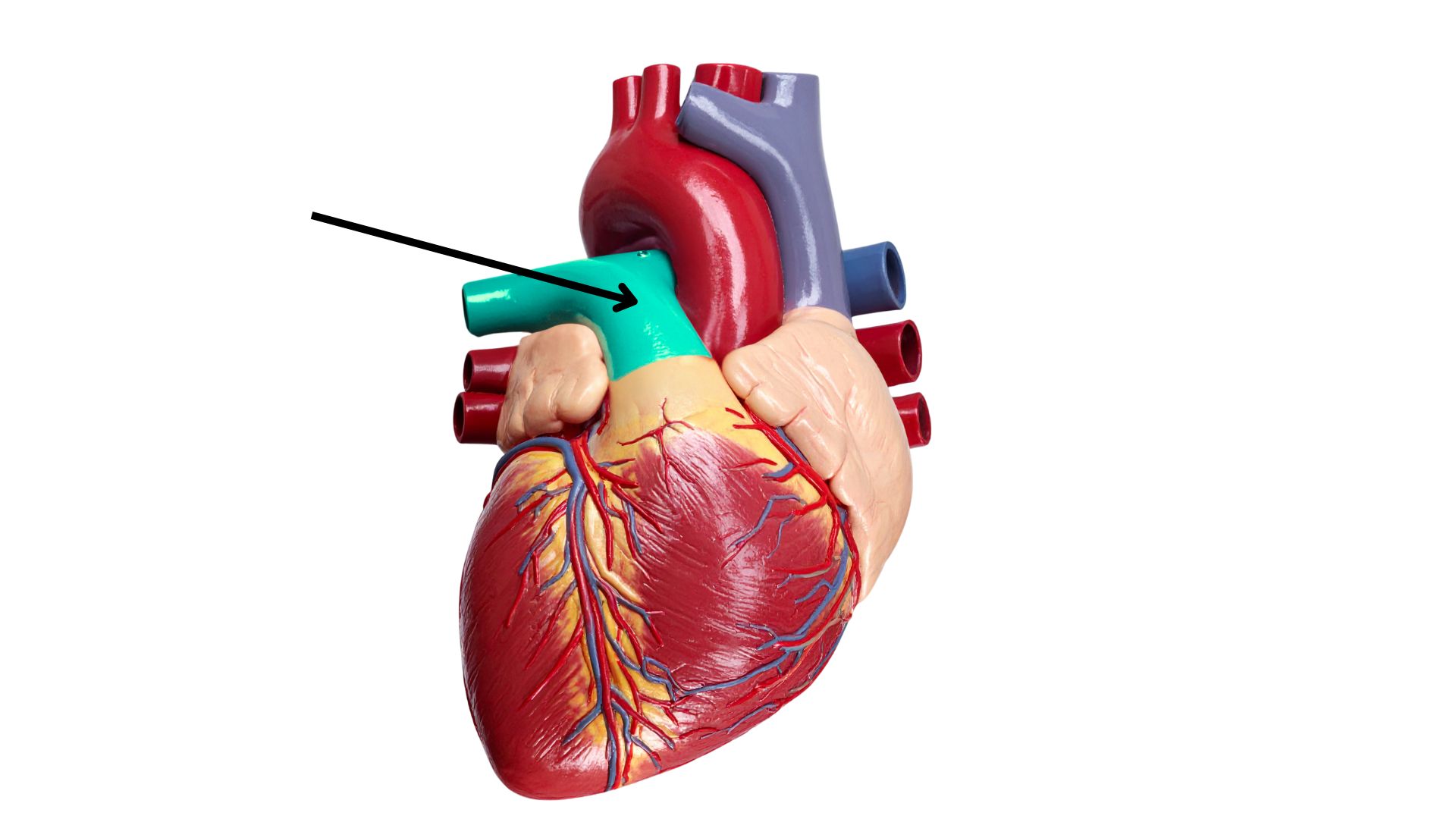 <p>What is the highlighted structure on the heart model below? [structure]</p>