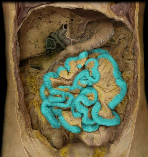 term image