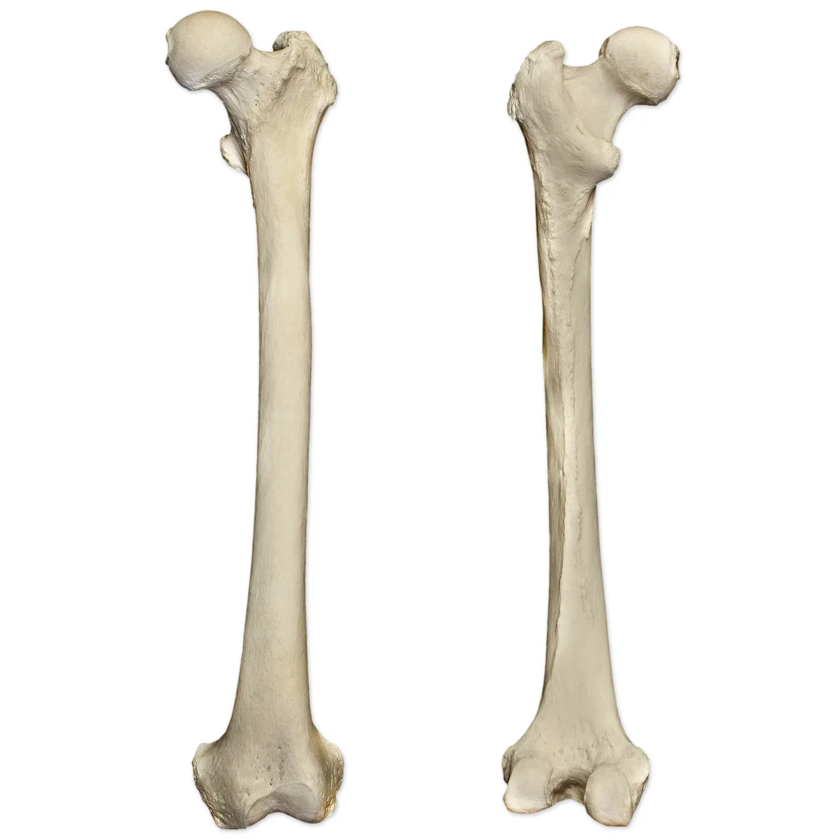 <p>Identify this bone (anterior/posterior)</p>