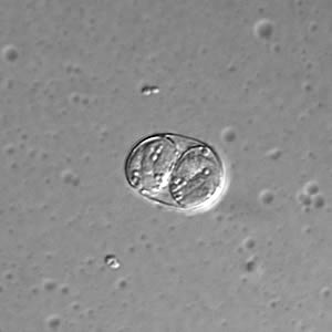 <ul><li><p>extremely difficult</p></li><li><p><strong>oocysts</strong> are pear or crescent-shaped and are called <em>tachyzoites </em>(visualized by hematoxylin stain)</p></li><li><p><strong>IgM specific tests</strong> can diagnose acute infections in neonates</p></li><li><p><strong>IFA and EIA tests are used routinely</strong></p></li></ul><p></p>