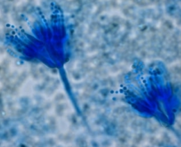 <p>Skeleton hand phialide and conidia arrangements</p>
