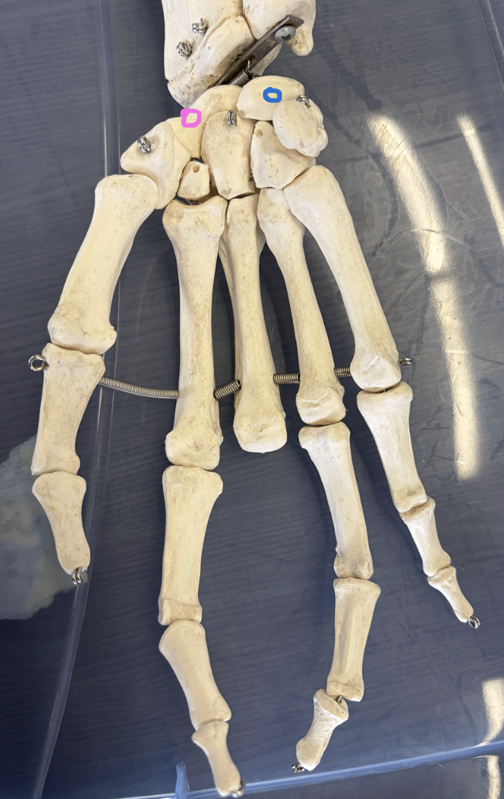 <p>Blue circle: What bone is this?</p><p>Pink circle: What bone is this? </p><p>What anatomical landmark is above the pink circle bone? </p><p>What forearm bone articulates with the blue circle?</p>