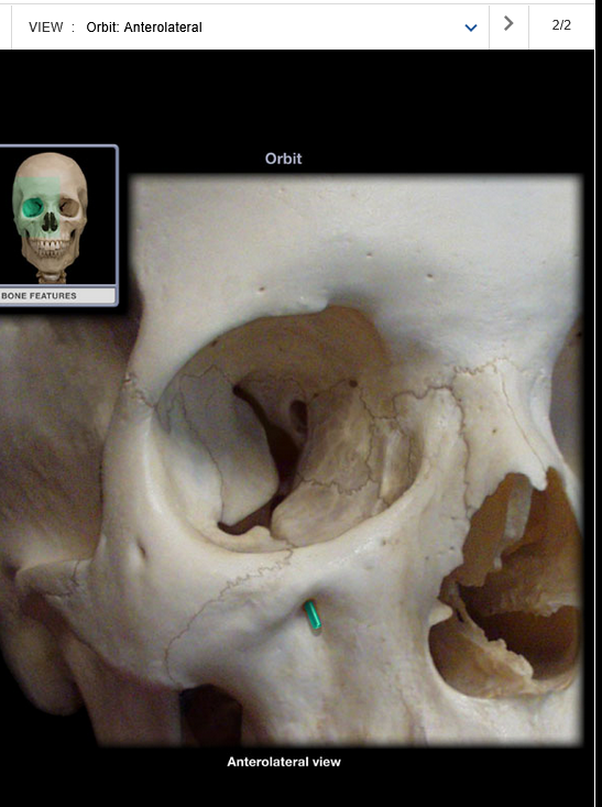 <p>Infraorbital foramen</p>